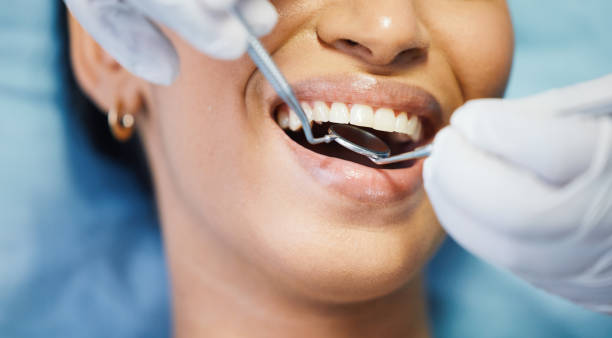 Best Emergency Wisdom Tooth Extraction in Clinton, AR