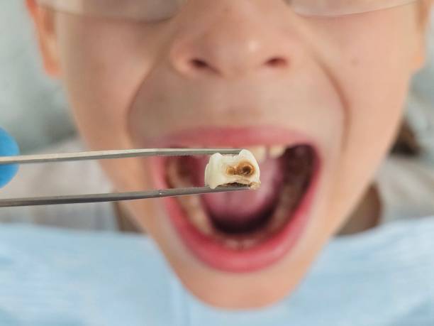 Best Weekend Emergency Dental Services in Clinton, AR